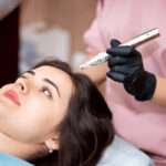 How Long Is the Recovery Time After a Hair Transplant in London?