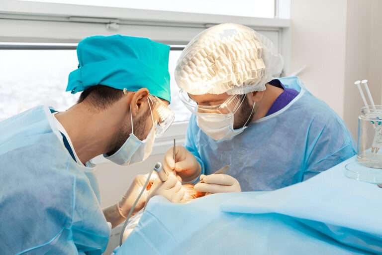 What to Know Before Booking Your Hair Transplant in London
