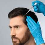 The Best Hair Transplant Clinics in London: A Comprehensive List