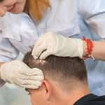 How to Choose the Best Hair Transplant Clinic in the UK