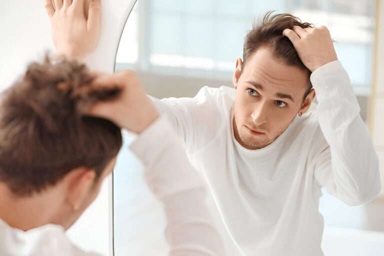 Can Hair Transplants Help with a Receding Hairline