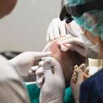 How to Choose Between FUE, FUT, and Other Hair Transplant Methods