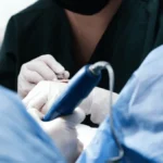 Why Should You Consider a Hair Transplant Over Other Treatments?