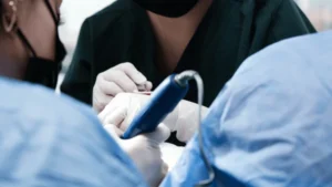 Hair Transplant