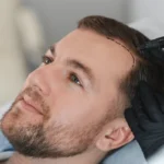 The Science Behind Hair Transplants: How Do They Really Work?