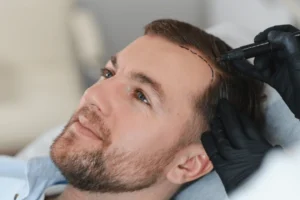 The Science Behind Hair Transplants: How Do They Really Work?