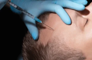 Hair Transplant