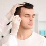 The Ultimate Hair Loss Showdown: Fin vs Min