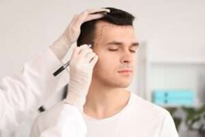 The Ultimate Hair Loss Showdown: Fin vs Min